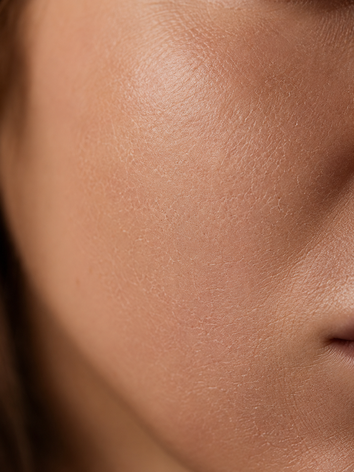 Face Whitening Cream — before