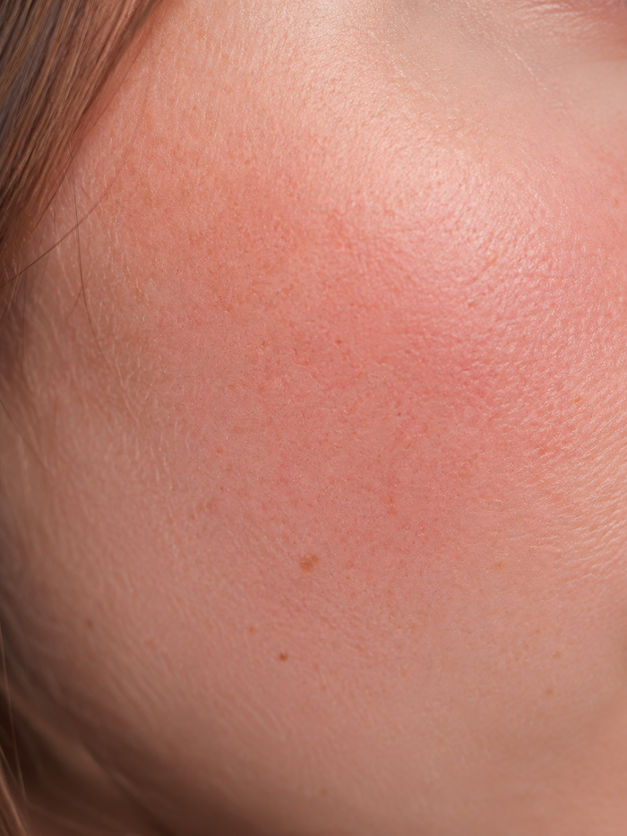 Face Whitening Cream — after